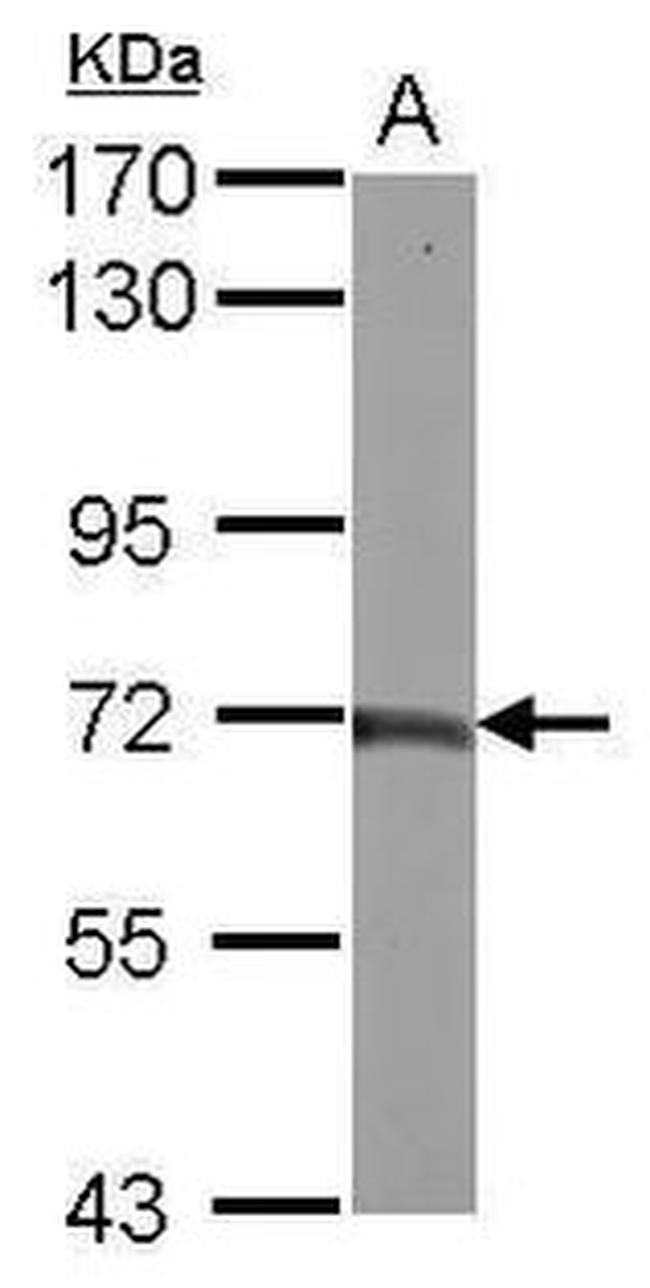 Tab2 Antibody in Western Blot (WB)