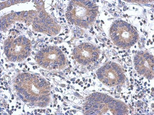 Fyn Antibody in Immunohistochemistry (Paraffin) (IHC (P))