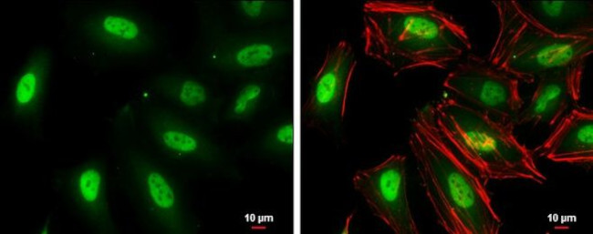 TKTL1 Antibody in Immunocytochemistry (ICC/IF)