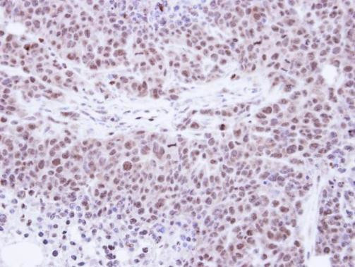 TKTL1 Antibody in Immunohistochemistry (Paraffin) (IHC (P))