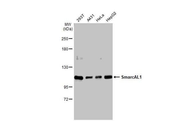 SMARCAL1 Antibody in Western Blot (WB)