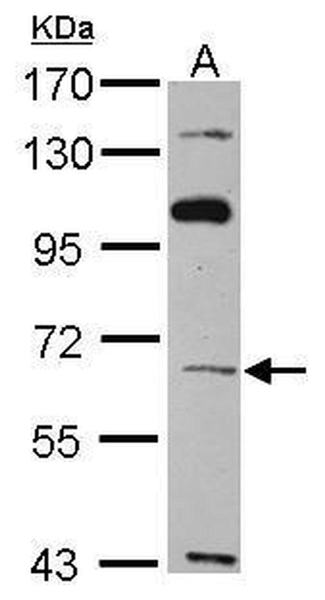 TBX4 Antibody in Western Blot (WB)