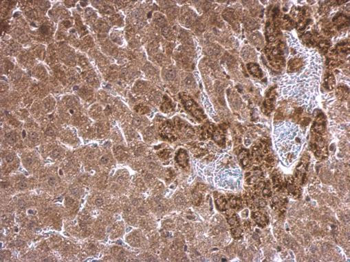 SCAP Antibody in Immunohistochemistry (Paraffin) (IHC (P))