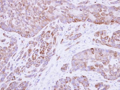 Cytokeratin 8 Antibody in Immunohistochemistry (Paraffin) (IHC (P))