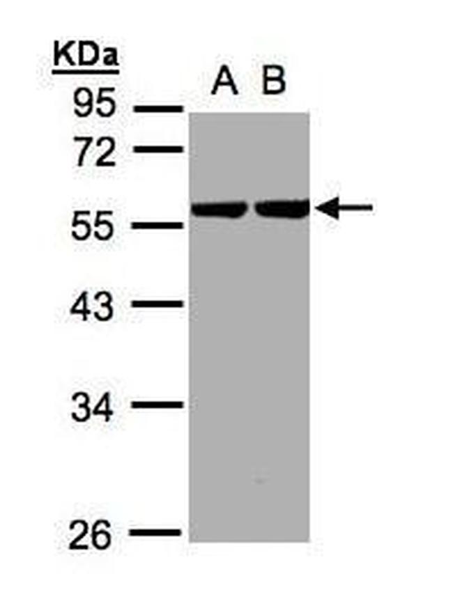 Cytokeratin 8 Antibody in Western Blot (WB)