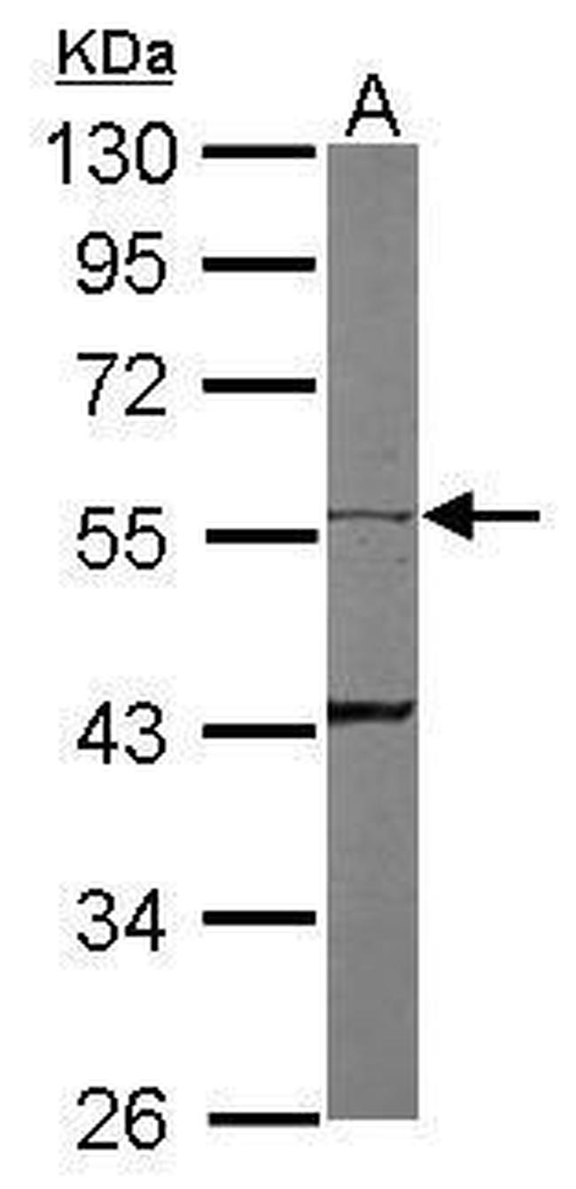 Cytokeratin 8 Antibody in Western Blot (WB)