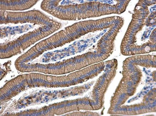 Cytokeratin 8 Antibody in Immunohistochemistry (Paraffin) (IHC (P))