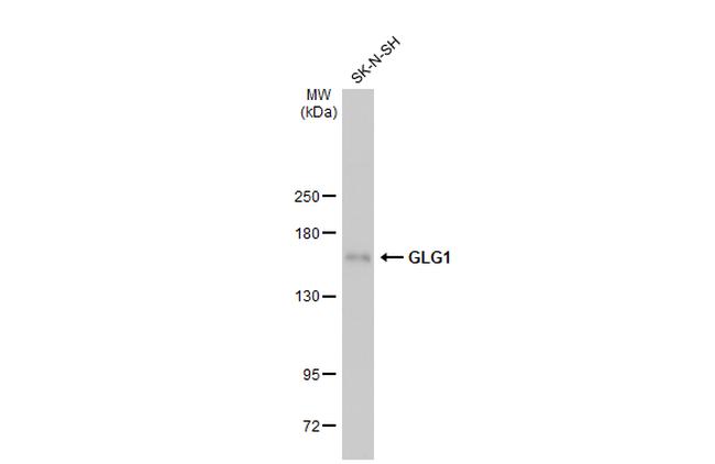 GLG1 Antibody in Western Blot (WB)