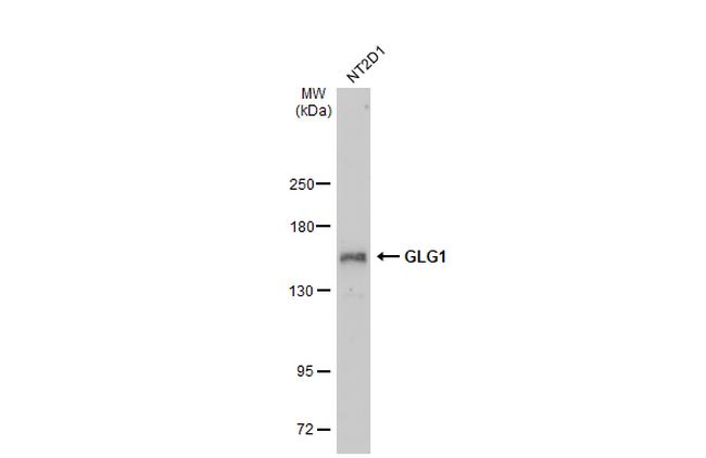 GLG1 Antibody in Western Blot (WB)