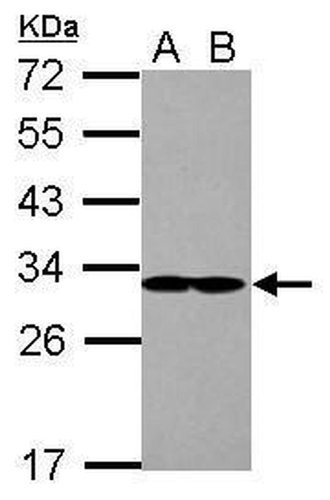 eIF2b alpha Antibody in Western Blot (WB)