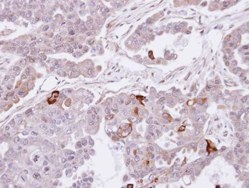 SEMA4A Antibody in Immunohistochemistry (Paraffin) (IHC (P))