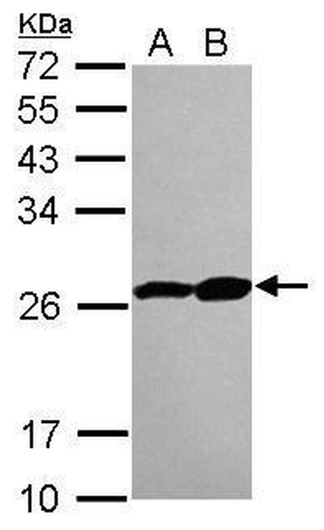 PSMB3 Antibody in Western Blot (WB)