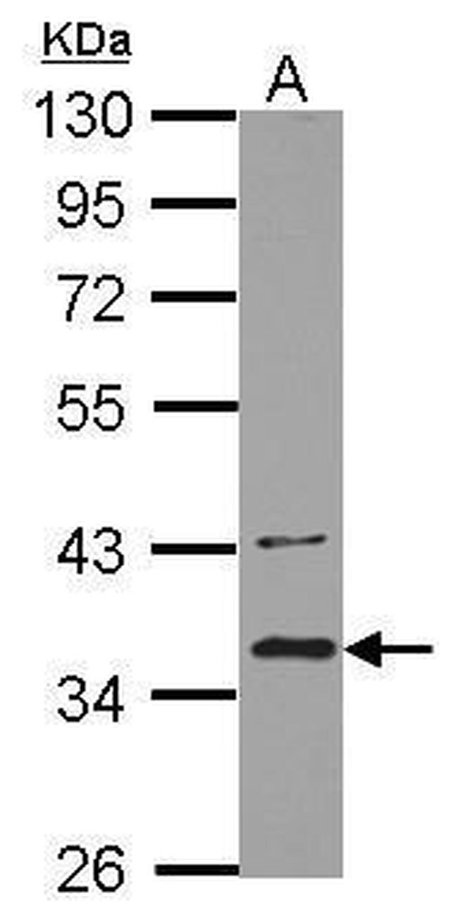 BRCC3 Antibody in Western Blot (WB)