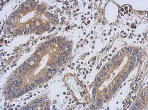 TNNT1 Antibody in Immunohistochemistry (Paraffin) (IHC (P))