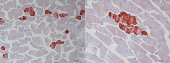 TNNT1 Antibody in Immunohistochemistry (Paraffin) (IHC (P))