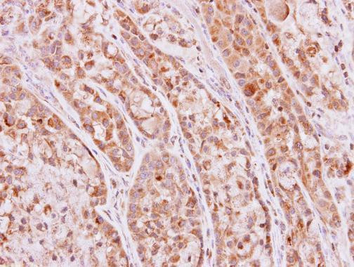 KHK Antibody in Immunohistochemistry (Paraffin) (IHC (P))