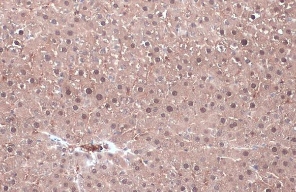 KHK Antibody in Immunohistochemistry (Paraffin) (IHC (P))