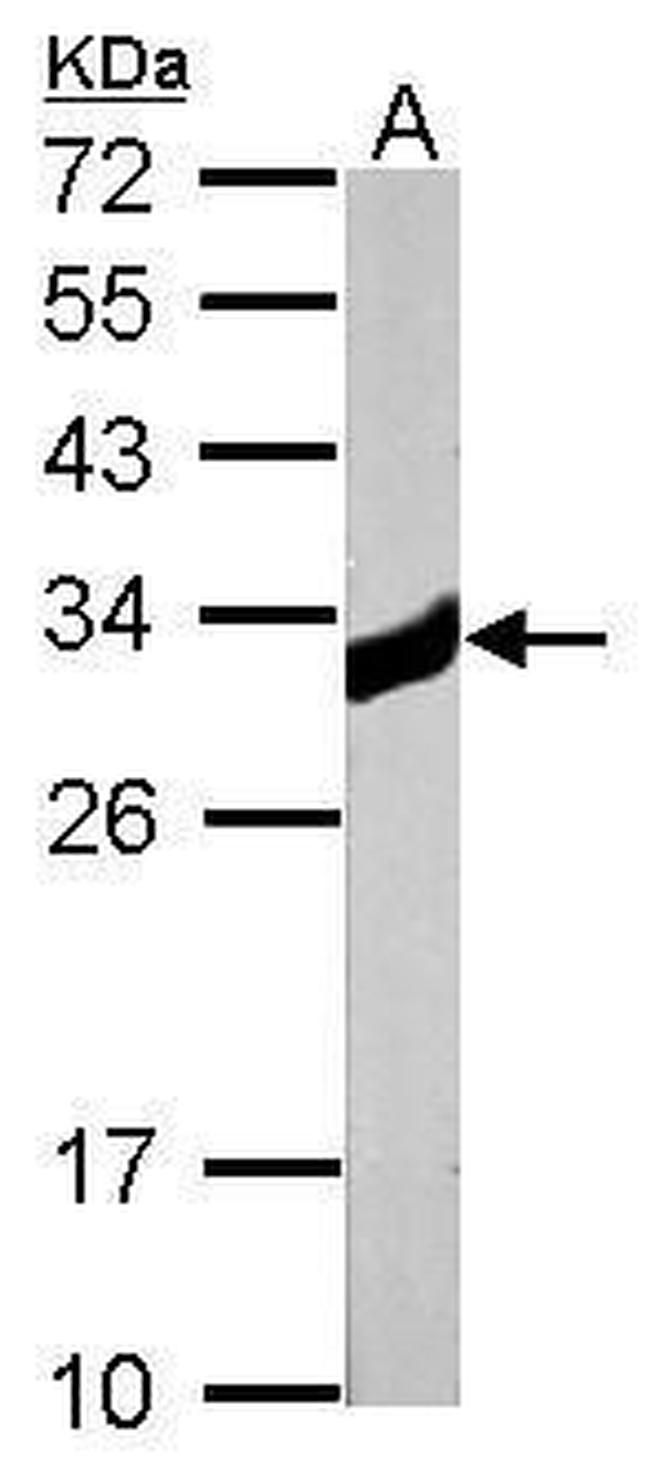 KHK Antibody in Western Blot (WB)