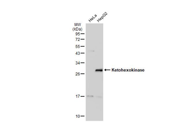 KHK Antibody in Western Blot (WB)