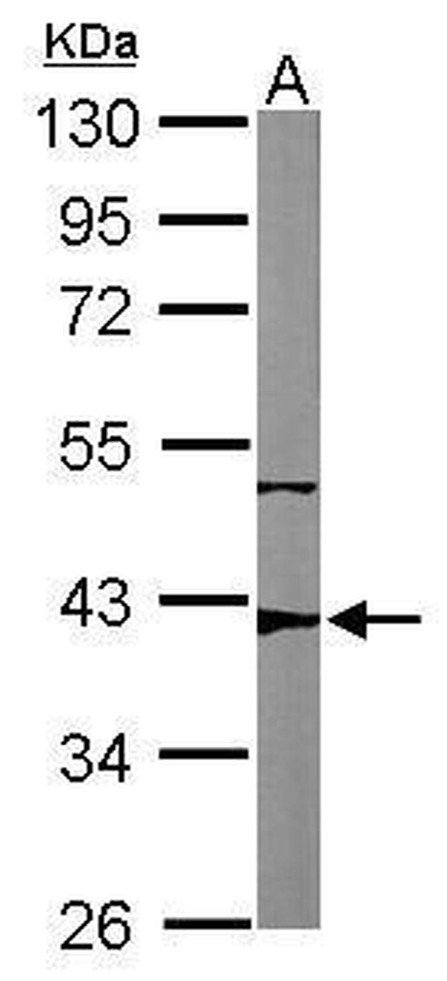 p53R2 Antibody in Western Blot (WB)