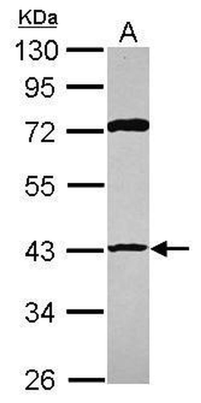 p53R2 Antibody in Western Blot (WB)