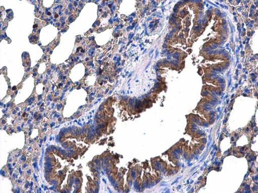 p53R2 Antibody in Immunohistochemistry (Paraffin) (IHC (P))