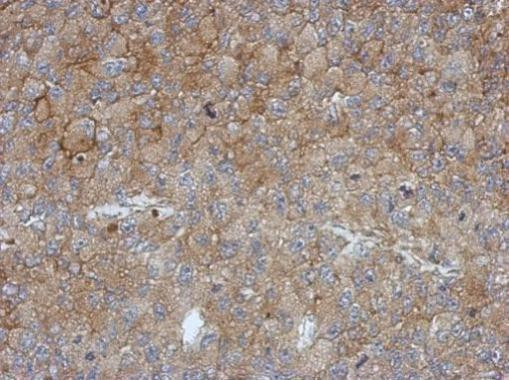 CCR5 Antibody in Immunohistochemistry (Paraffin) (IHC (P))