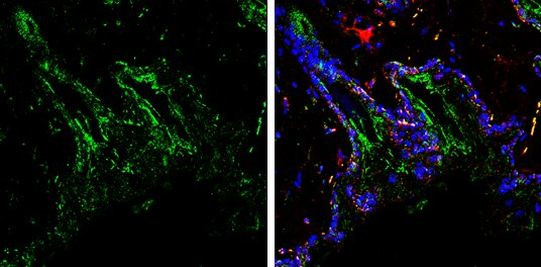 PGP9.5 Antibody in Immunohistochemistry (Paraffin) (IHC (P))