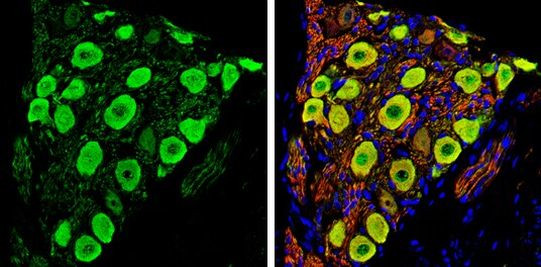 PGP9.5 Antibody in Immunohistochemistry (Paraffin) (IHC (P))