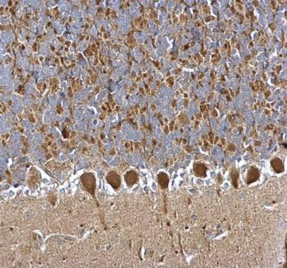 PGP9.5 Antibody in Immunohistochemistry (Paraffin) (IHC (P))