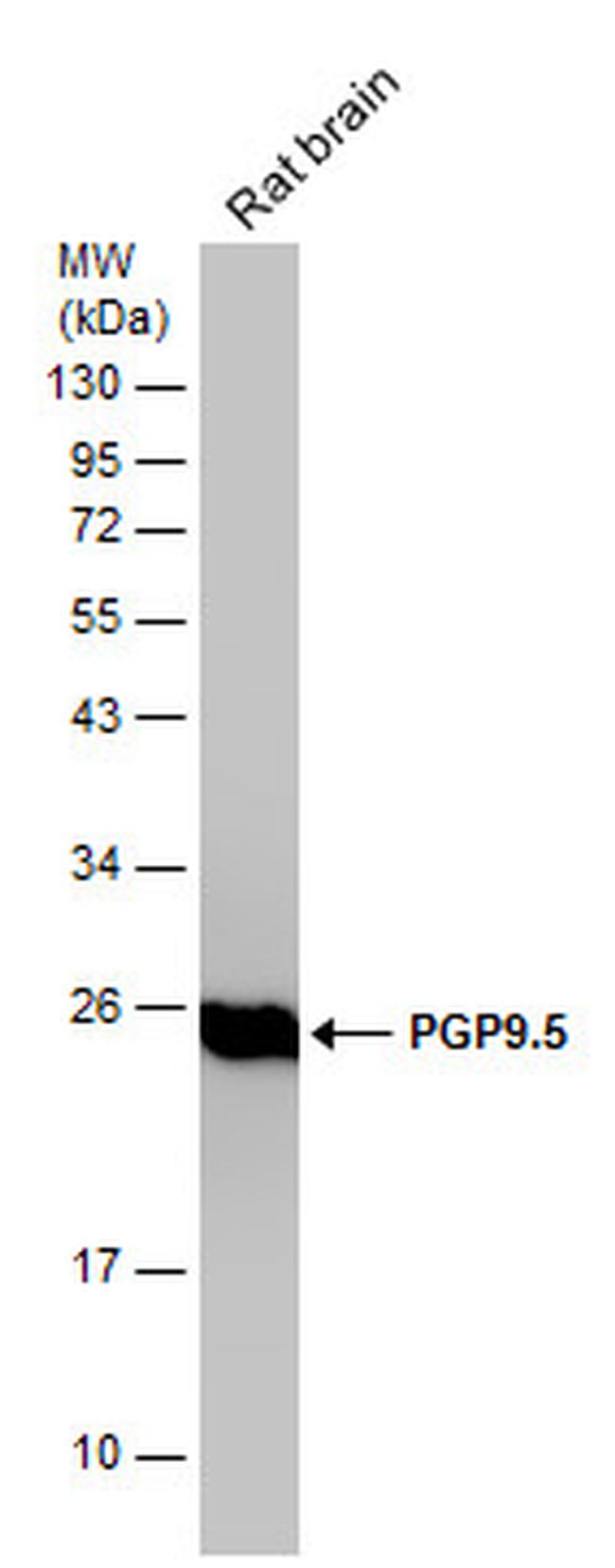 PGP9.5 Antibody in Western Blot (WB)