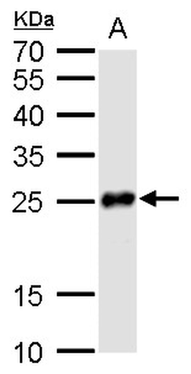 PGP9.5 Antibody in Western Blot (WB)