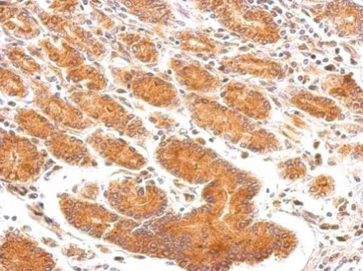 EEA1 Antibody in Immunohistochemistry (Paraffin) (IHC (P))