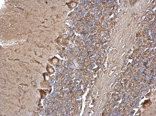 EEA1 Antibody in Immunohistochemistry (Paraffin) (IHC (P))