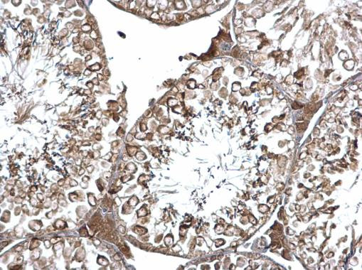 EEA1 Antibody in Immunohistochemistry (Paraffin) (IHC (P))