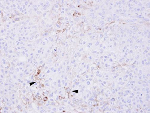 CCR6 Antibody in Immunohistochemistry (Paraffin) (IHC (P))