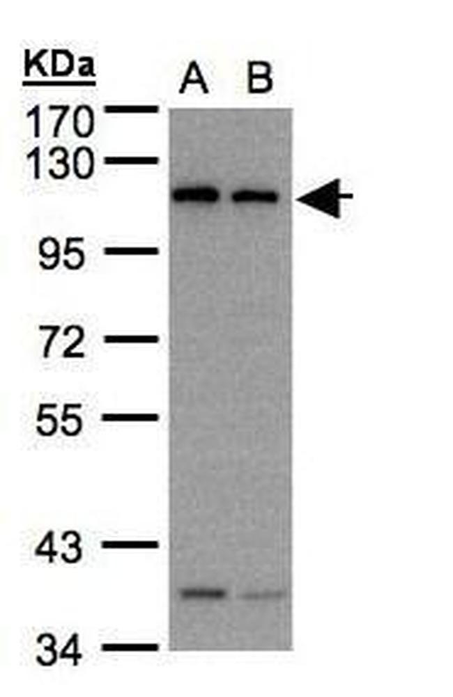 Dynamin 2 Antibody in Western Blot (WB)