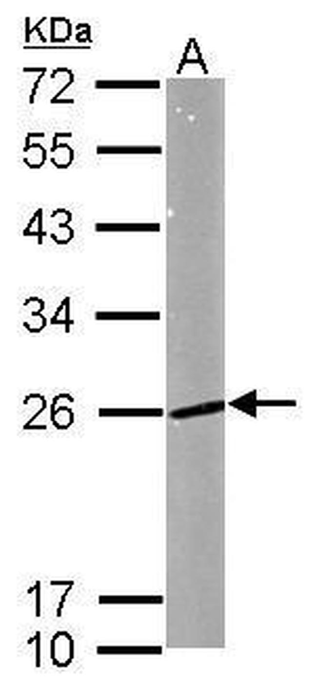 RAB5 Antibody in Western Blot (WB)