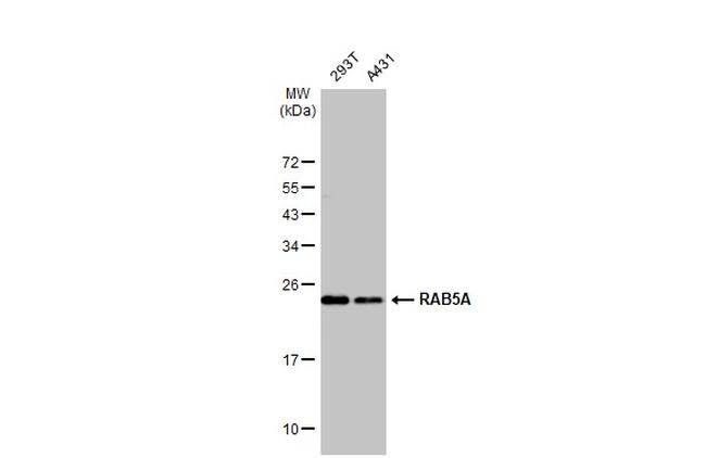 RAB5 Antibody in Western Blot (WB)