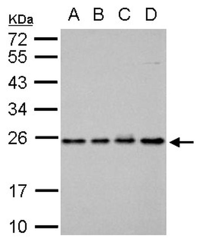 RAB5 Antibody in Western Blot (WB)