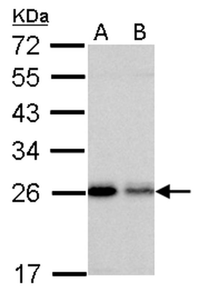 RAB5 Antibody in Western Blot (WB)