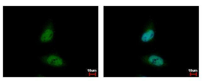 HDAC3 Antibody in Immunocytochemistry (ICC/IF)