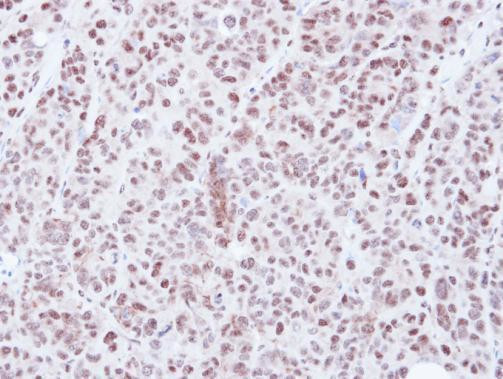 HDAC3 Antibody in Immunohistochemistry (Paraffin) (IHC (P))