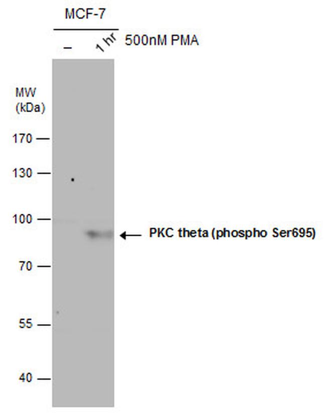 Phospho-PKC theta (Ser695) Antibody in Western Blot (WB)