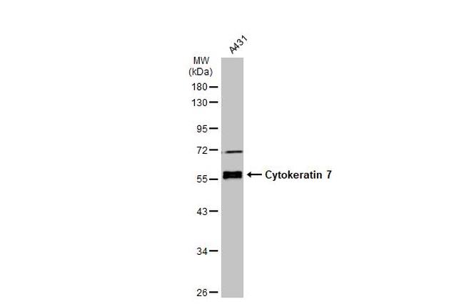 Cytokeratin 7 Antibody in Western Blot (WB)