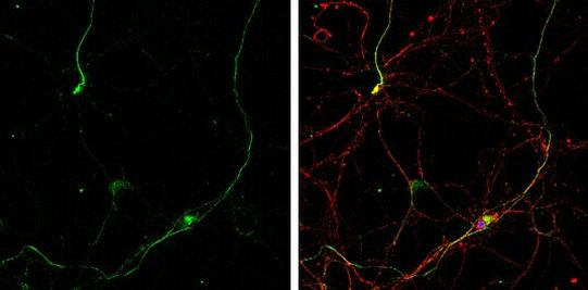 Gephyrin Antibody in Immunocytochemistry (ICC/IF)