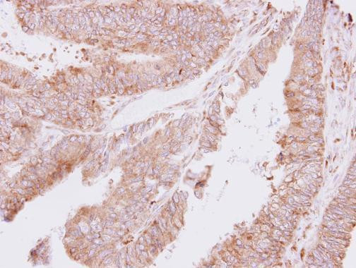 TARS Antibody in Immunohistochemistry (Paraffin) (IHC (P))