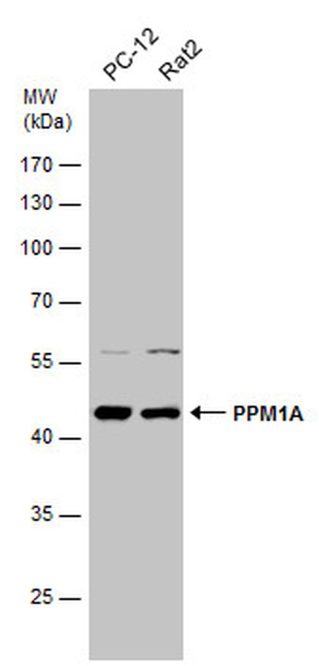 PPM1A Antibody in Western Blot (WB)