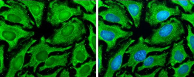 HSP90 alpha Antibody in Immunocytochemistry (ICC/IF)