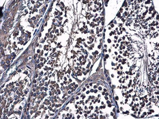 HSP90 alpha Antibody in Immunohistochemistry (Paraffin) (IHC (P))